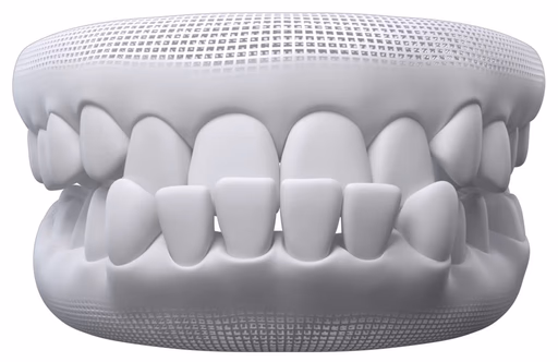 Underbite